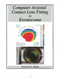 Computer Assisted Contact Lens Fitting In Keratoconus.